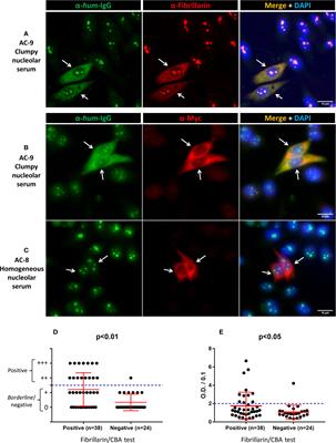 A cell-based assay for detection of anti-fibrillarin autoantibodies with performance equivalent to immunoprecipitation